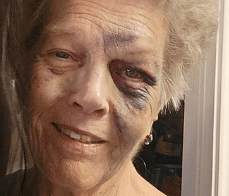 Carjacker Dies in Fatal Accident Shortly After Brutally Beating 72-Year-Old Grandmother and Stealing Her Car