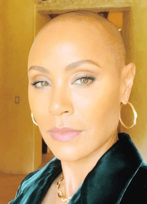The Breakfast Club Says Jada Pinkett Smith Talking About Her Alopecia Sets the Tone for the Discussion About the Will Smith and Chris Rock Slap (VIDEO)