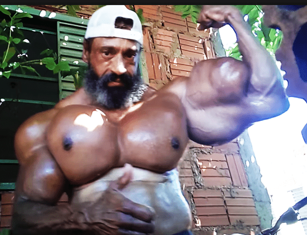 Brazilian Bodybuilder Who Injected Himself with Oil Dies on his Birthday (video)