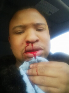 Andrew Caldwell Attacked by Two Men