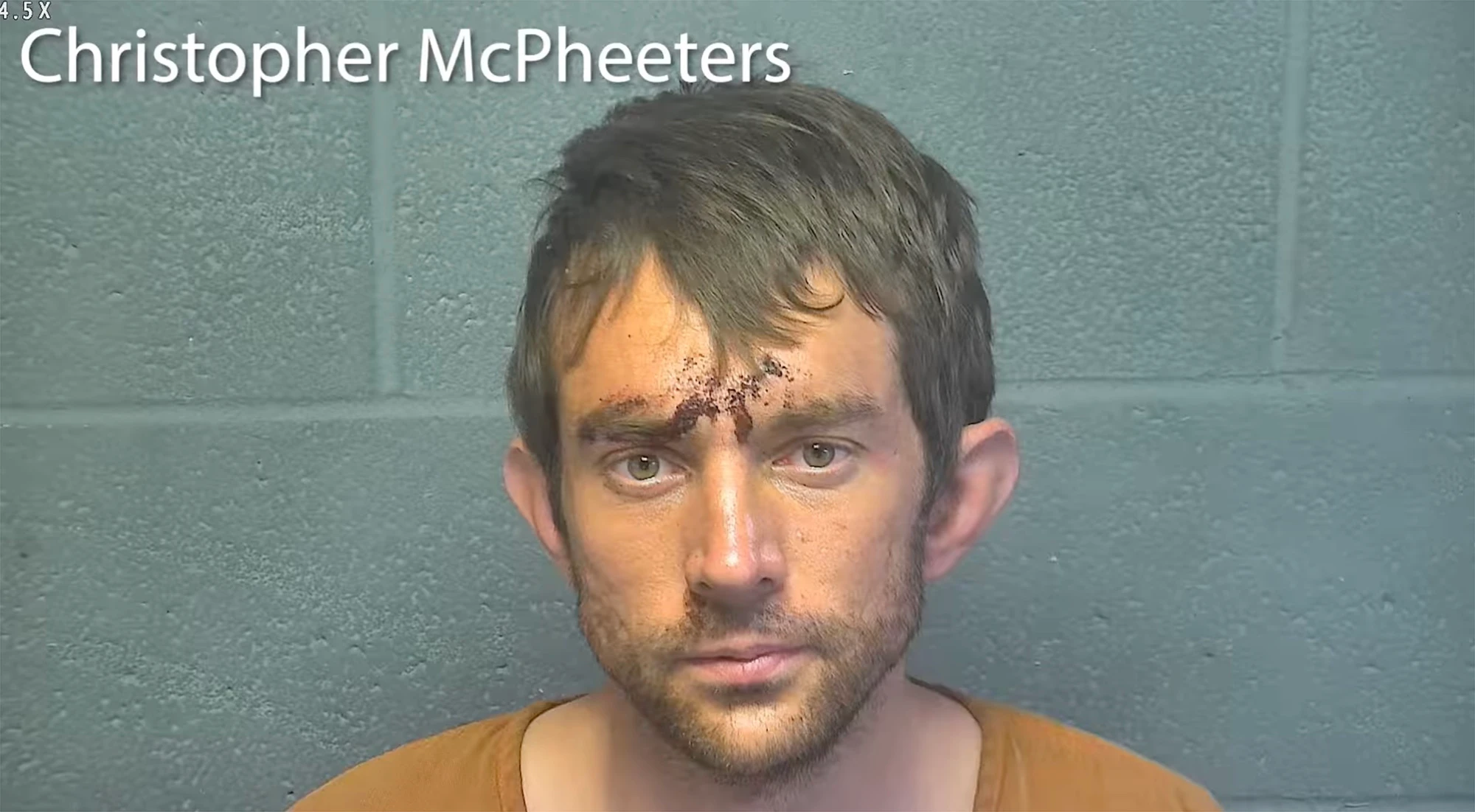Oklahoma Officer Stabbed in Eye With Glass Shard by Suspect