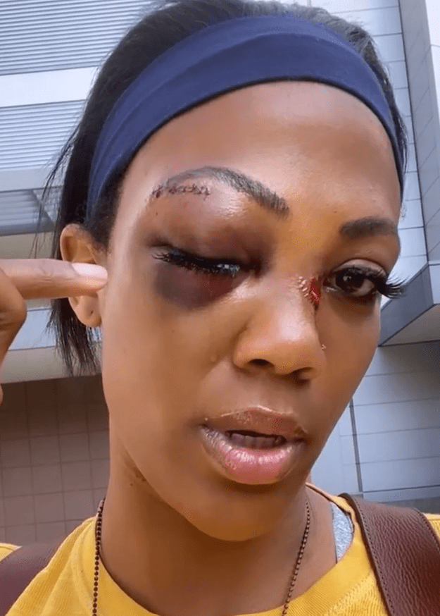 Homeless Man Attacks Olympian with Metal Pipe