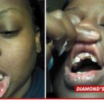 Angie Stone Arrested for Knocking Daughter's Teeth Out
