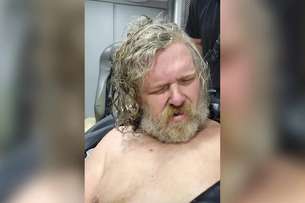 Woman Names Brother as Attacker After 2-Year Coma